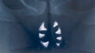Cartel censurado de Teeth