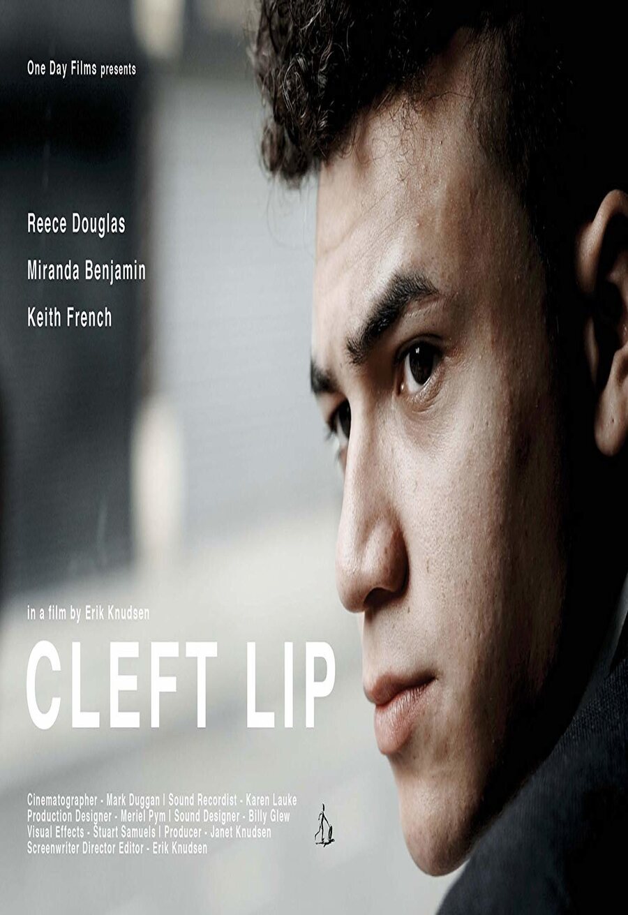 Cartel de Cleft Lip - 