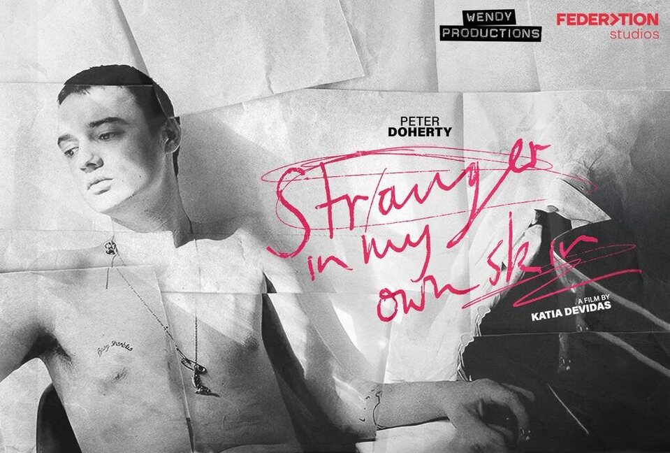 Peter Doherty: Stranger in My Own Skin