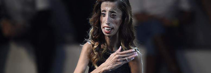 Lizzie Velasquez