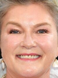 Kate Mulgrew
