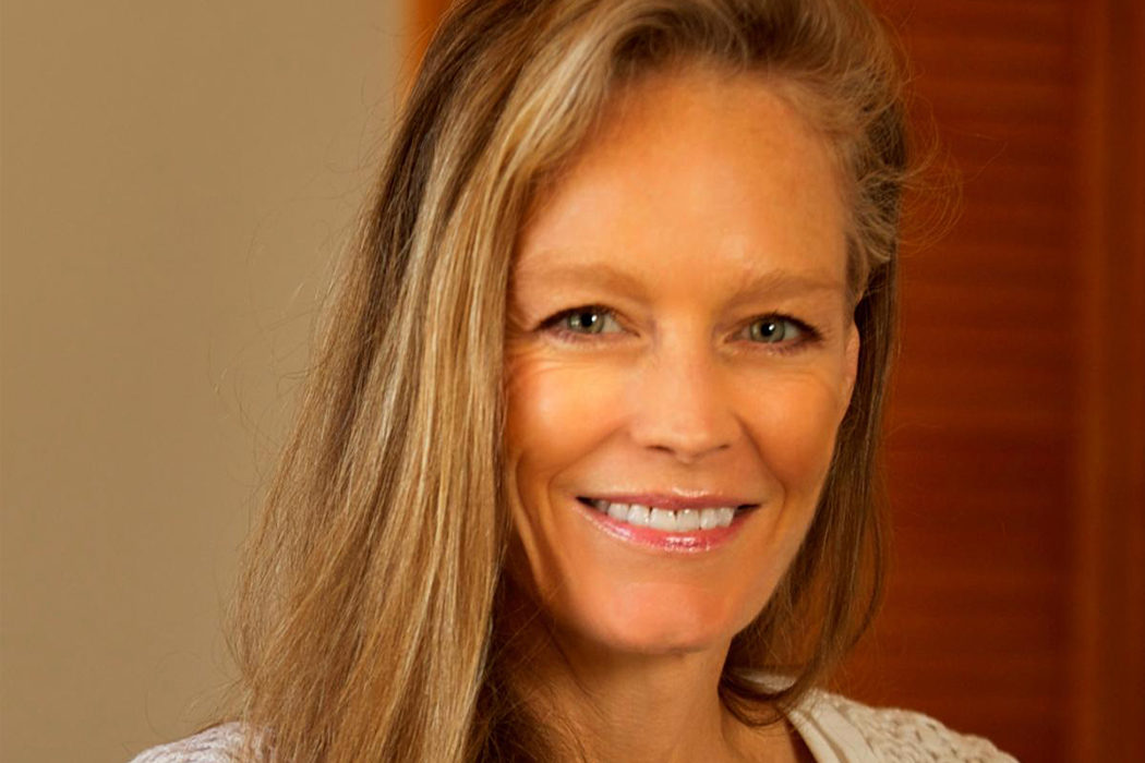 Suzy Amis