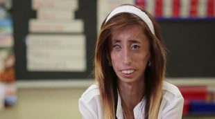 Tráiler 'A Brave Heart: The Lizzie Velasquez Story'